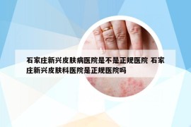 石家莊新興皮膚病醫(yī)院是不是正規(guī)醫(yī)院 石家莊新興皮膚科醫(yī)院是正規(guī)醫(yī)院嗎