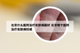 北京什么醫(yī)院治療皮膚病最好 北京哪個(gè)醫(yī)院治療皮膚病權(quán)威