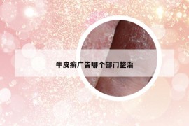 牛皮癬廣告哪個部門整治