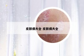 皮膚病大全 皮膚病大全
