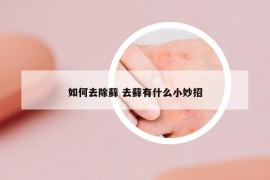 如何去除蘚 去蘚有什么小妙招
