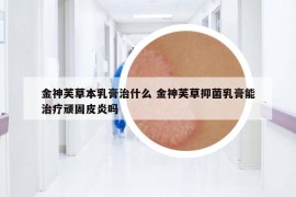 金神芙草本乳膏治什么 金神芙草抑菌乳膏能治療頑固皮炎嗎