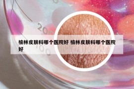 榆林皮膚科哪個醫(yī)院好 榆林皮膚科哪個醫(yī)院好