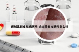 運(yùn)城禹都皮膚病醫(yī)院 運(yùn)城禹都皮膚科怎么樣