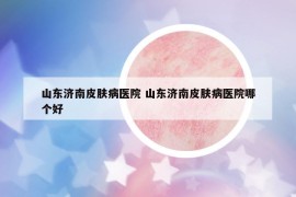 山東濟(jì)南皮膚病醫(yī)院 山東濟(jì)南皮膚病醫(yī)院哪個(gè)好