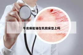 牛皮癬能鋪在乳膠床墊上嗎