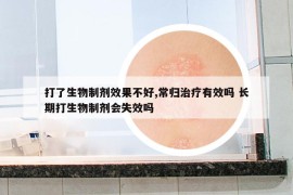 打了生物制劑效果不好,常歸治療有效嗎 長期打生物制劑會失效嗎