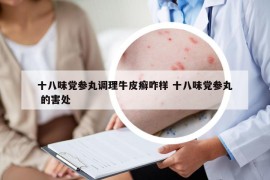 十八味黨參丸調(diào)理牛皮癬咋樣 十八味黨參丸 的害處