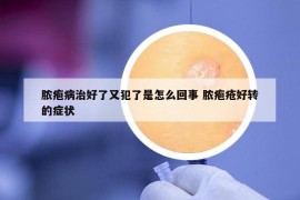 膿皰病治好了又犯了是怎么回事 膿皰瘡好轉(zhuǎn)的癥狀