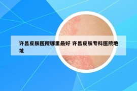 許昌皮膚醫(yī)院哪里最好 許昌皮膚?？漆t(yī)院地址