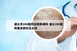 通化市206醫(yī)院治銀屑病嗎 通化206醫(yī)院看皮膚科怎么樣