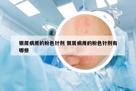 銀屑病用的粉色針劑 銀屑病用的粉色針劑有哪些