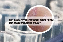 煙臺(tái)市農(nóng)科院中醫(yī)皮膚病醫(yī)院怎么樣 煙臺(tái)市農(nóng)科院中醫(yī)皮膚病醫(yī)院怎么樣?