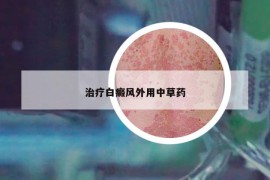 治療白癜風(fēng)外用中草藥