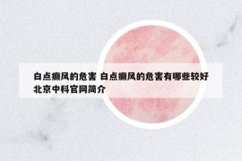 白點(diǎn)癲風(fēng)的危害 白點(diǎn)癲風(fēng)的危害有哪些較好北京中科官網(wǎng)簡(jiǎn)介