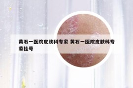 黃石一醫(yī)院皮膚科專家 黃石一醫(yī)院皮膚科專家掛號