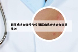 銀屑病適合哪種氣候 銀屑病患者適合在哪里生活