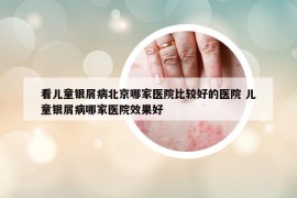 看兒童銀屑病北京哪家醫(yī)院比較好的醫(yī)院 兒童銀屑病哪家醫(yī)院效果好