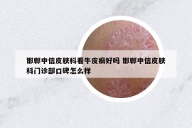 邯鄲中信皮膚科看牛皮癬好嗎 邯鄲中信皮膚科門(mén)診部口碑怎么樣