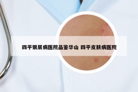 四平銀屑病醫(yī)院品鑒華山 四平皮膚病醫(yī)院
