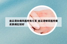 連云港白癜風(fēng)醫(yī)院有幾家 連云港哪家醫(yī)院看皮膚病比較好
