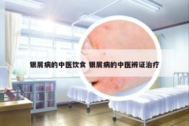 銀屑病的中醫(yī)飲食 銀屑病的中醫(yī)辨證治療