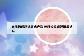 無(wú)限極調(diào)理銀屑病產(chǎn)品 無(wú)限極能調(diào)好銀屑病嗎