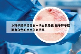 小孩子脖子后面有一塊白色胎記 孩子脖子后面有白色的點(diǎn)點(diǎn)怎么回事