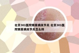 北京301醫(yī)院銀屑病關(guān)節(jié)炎 北京301醫(yī)院銀屑病關(guān)節(jié)炎怎么樣