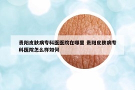 貴陽皮膚病?？漆t(yī)醫(yī)院在哪里 貴陽皮膚病專科醫(yī)院怎么樣如何