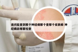 請(qǐng)問(wèn)能查到那個(gè)神經(jīng)病那個(gè)查那個(gè)皮膚癬 神經(jīng)病去哪里檢查