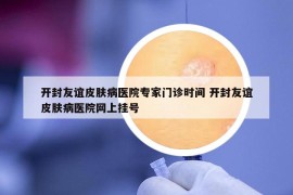 開封友誼皮膚病醫(yī)院專家門診時(shí)間 開封友誼皮膚病醫(yī)院網(wǎng)上掛號(hào)