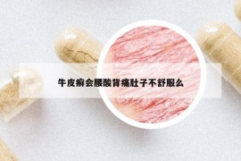 牛皮癬會腰酸背痛肚子不舒服么