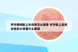 懷孕期間臉上長(zhǎng)白斑怎么回事 懷孕臉上出現(xiàn)白色的小塊是什么原因