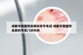 成都華西醫(yī)院皮膚科掛號(hào)電話 成都華西醫(yī)院皮膚科專家門診時(shí)間