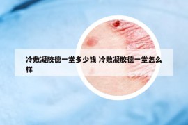 冷敷凝膠德一堂多少錢 冷敷凝膠德一堂怎么樣