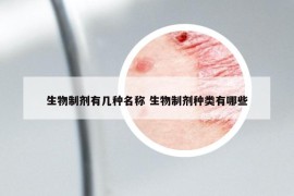 生物制劑有幾種名稱 生物制劑種類有哪些