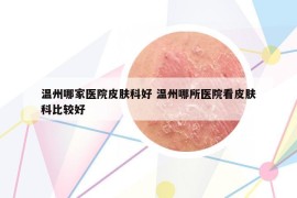 溫州哪家醫(yī)院皮膚科好 溫州哪所醫(yī)院看皮膚科比較好