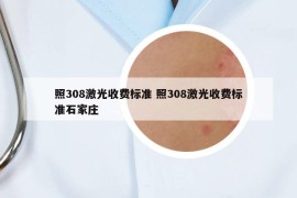 照308激光收費標準 照308激光收費標準石家莊