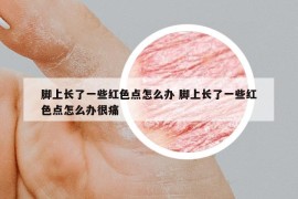 腳上長了一些紅色點怎么辦 腳上長了一些紅色點怎么辦很痛