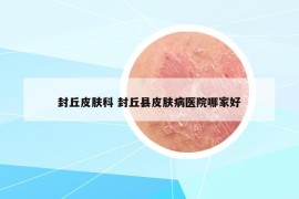封丘皮膚科 封丘縣皮膚病醫(yī)院哪家好
