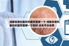 成都皮膚科最好的醫(yī)院是哪一個(gè) 成都皮膚科最好的醫(yī)院是哪一個(gè)較好 潤禾平價(jià)收費(fèi)