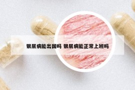 銀屑病能出國嗎 銀屑病能正常上班嗎