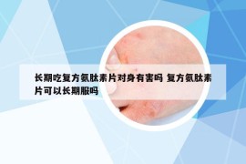 長期吃復(fù)方氨肽素片對(duì)身有害嗎 復(fù)方氨肽素片可以長期服嗎