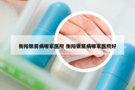 衡陽銀屑病哪家醫(yī)院 衡陽銀屑病哪家醫(yī)院好