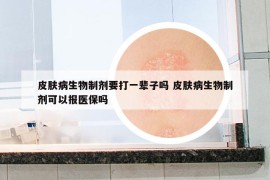 皮膚病生物制劑要打一輩子嗎 皮膚病生物制劑可以報(bào)醫(yī)保嗎