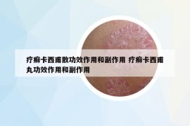 療癬卡西甫散功效作用和副作用 療癬卡西甫丸功效作用和副作用