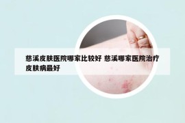 慈溪皮膚醫(yī)院哪家比較好 慈溪哪家醫(yī)院治療皮膚病最好