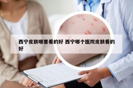 西寧皮膚哪里看的好 西寧哪個醫(yī)院皮膚看的好