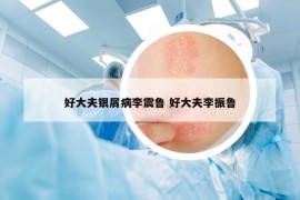 好大夫銀屑病李震魯 好大夫李振魯